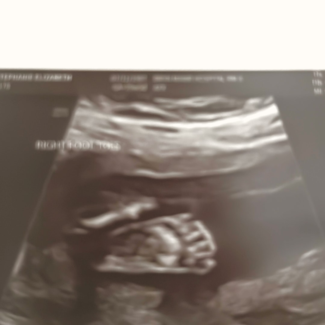 Photo shared by Stephanie for their Babylist baby registry.