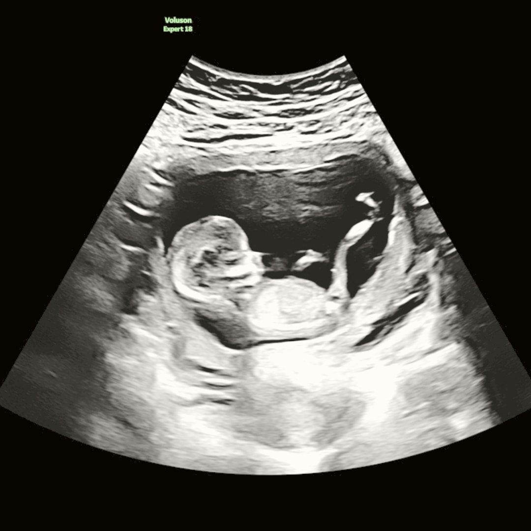 Photo shared by Jayde for their Babylist baby registry.