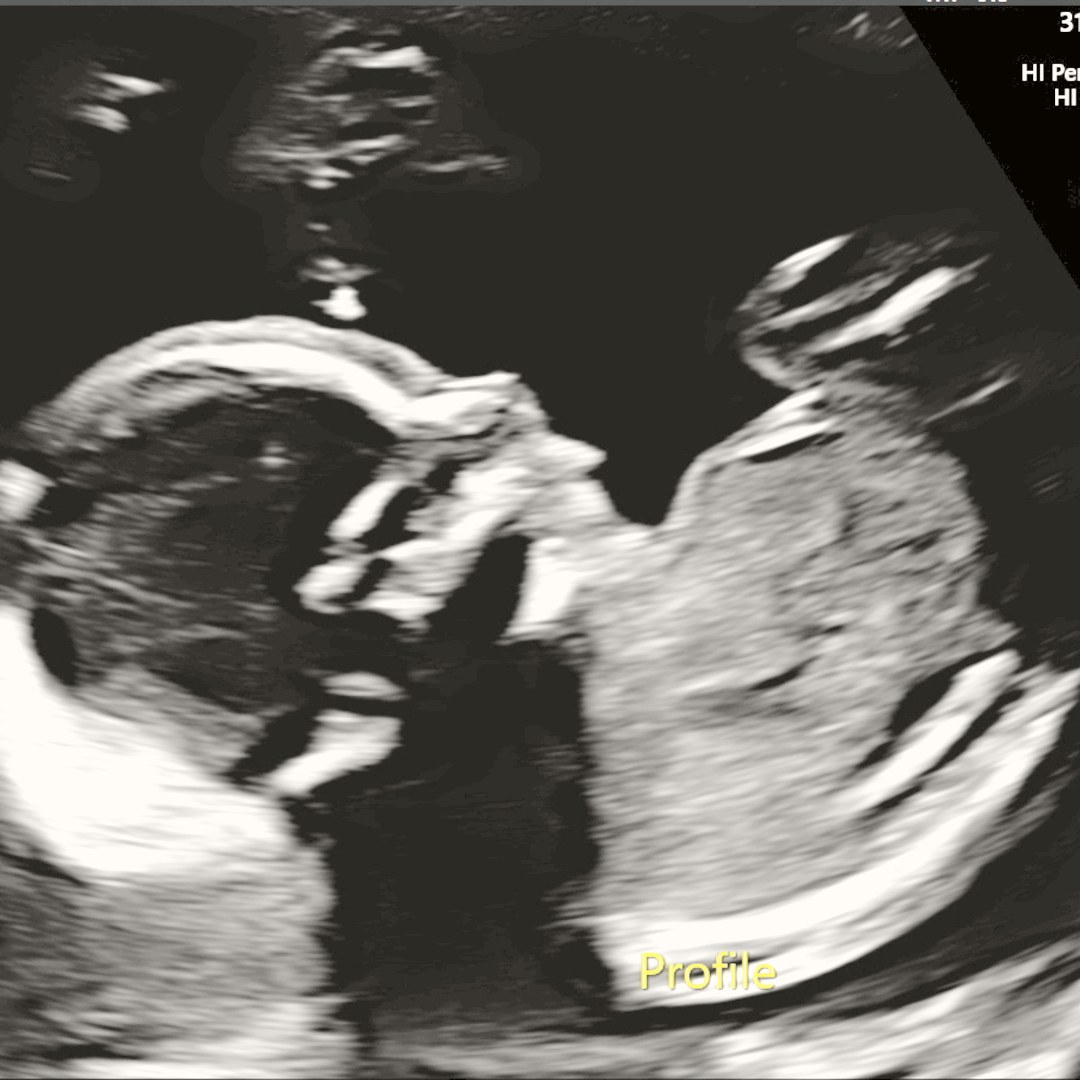 Photo shared by Ro for their Babylist baby registry.