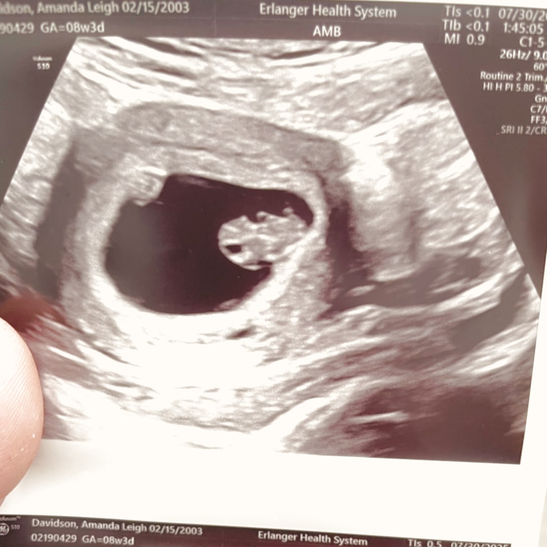Photo shared by Amanda for their Babylist baby registry.
