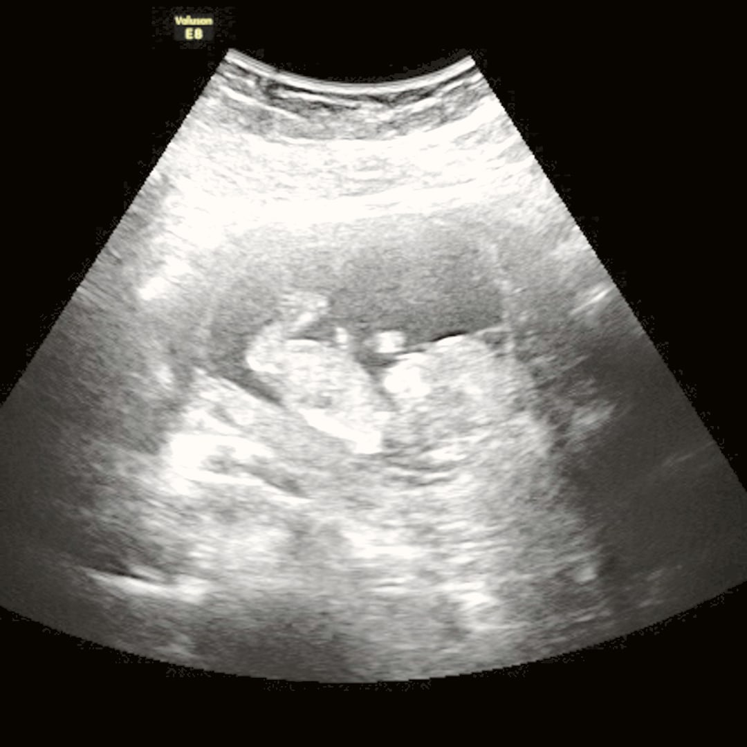 Photo shared by Kelby for their Babylist baby registry.