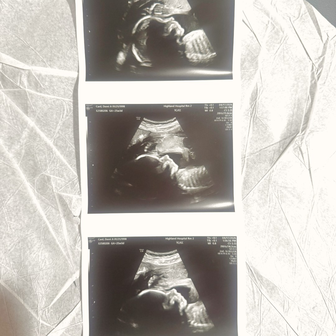 Photo shared by Demi for their Babylist baby registry.