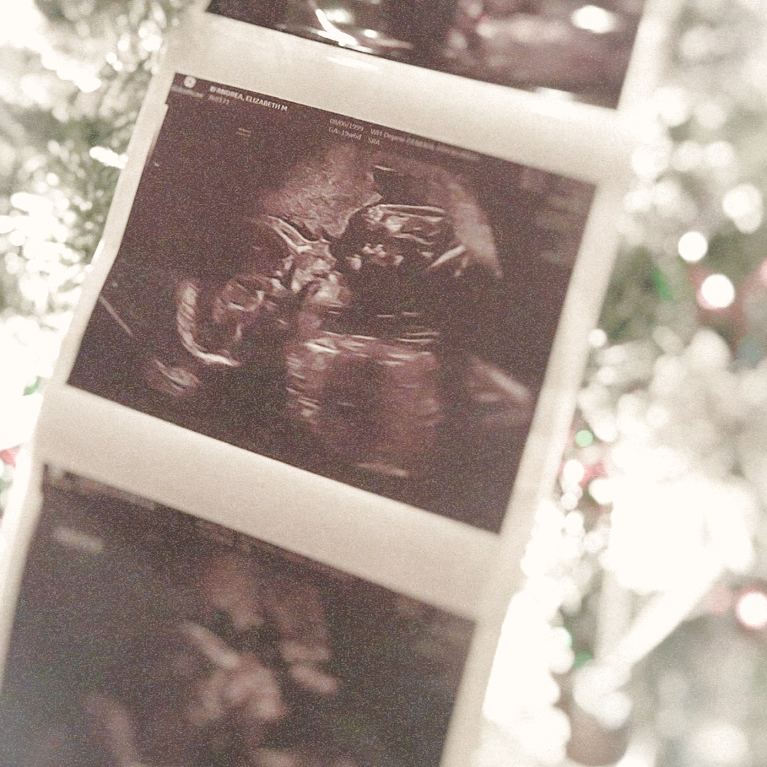 Photo shared by Elizabeth for their Babylist baby registry.