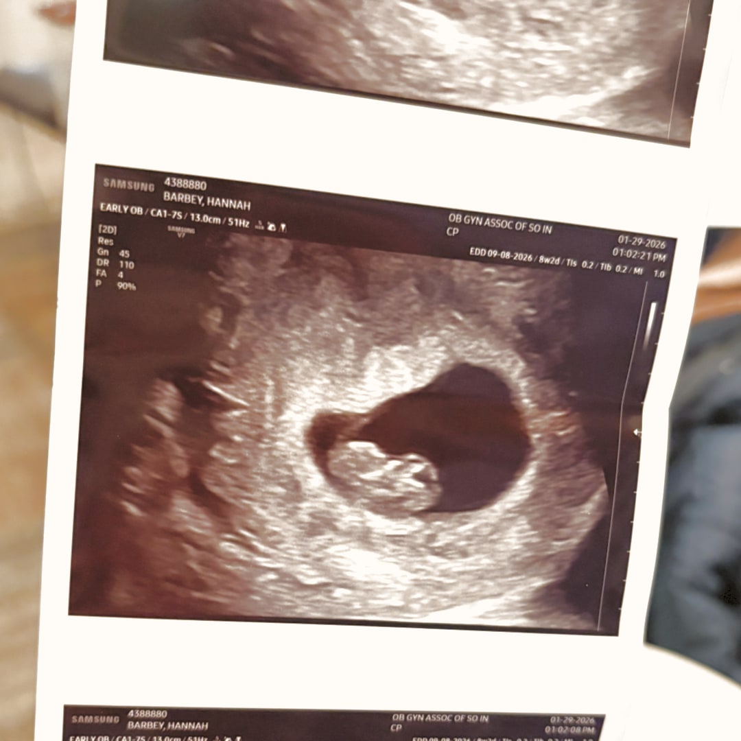 Photo shared by Hannah for their Babylist baby registry.