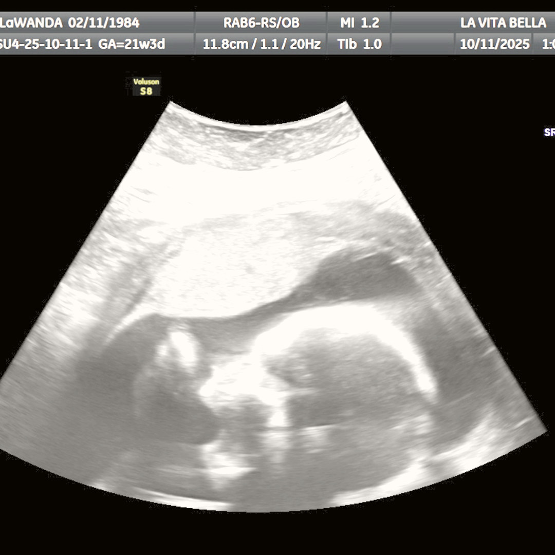 Photo shared by LaWanda for their Babylist baby registry.