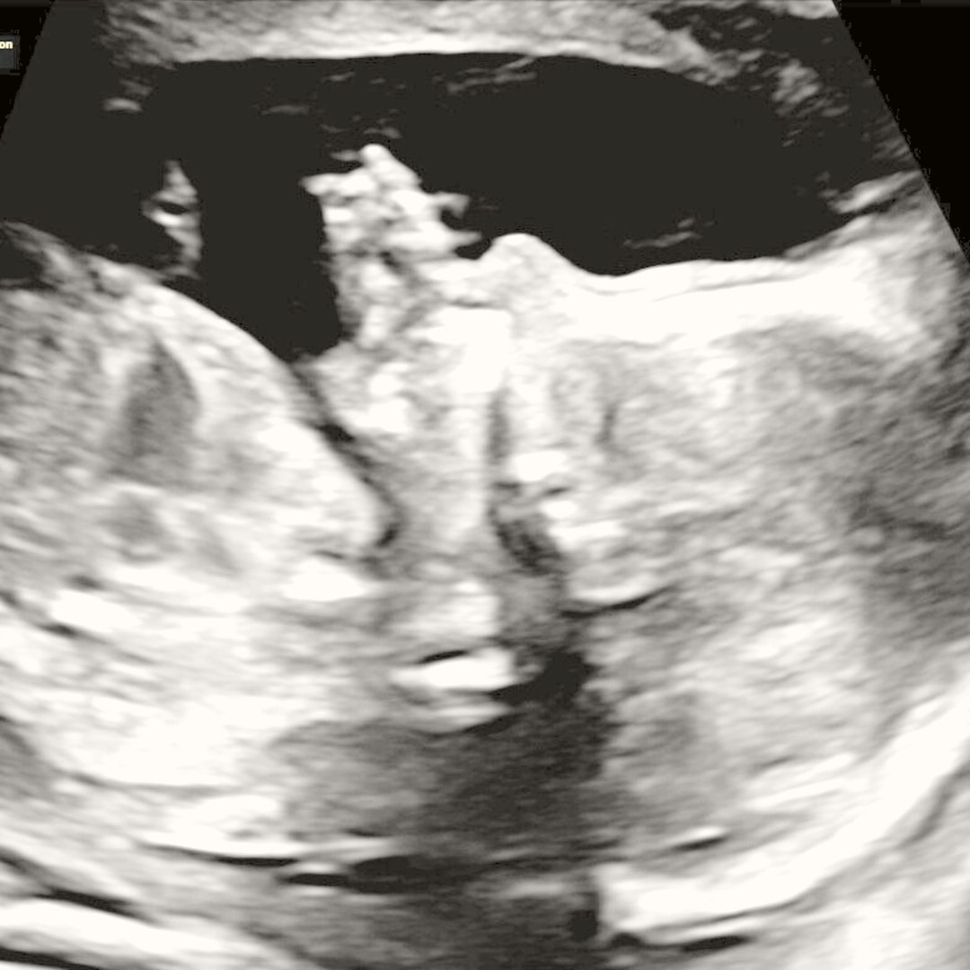 Photo shared by Mariana for their Babylist baby registry.