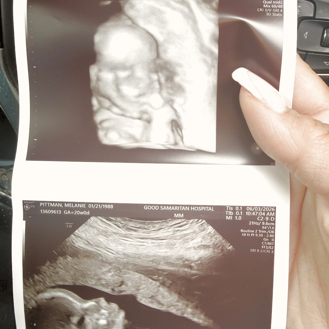 Photo shared by Melanie for their Babylist baby registry.