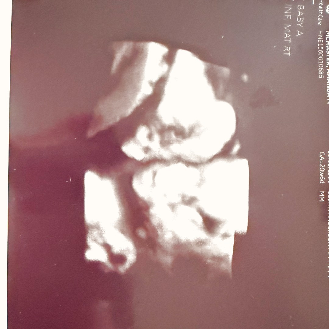 Photo shared by Amanda for their Babylist baby registry.