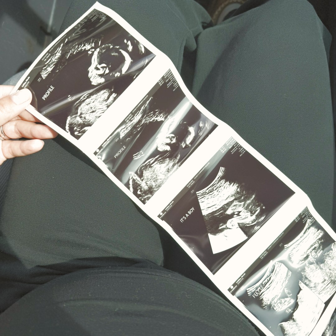 Photo shared by Nicole Kay for their Babylist baby registry.