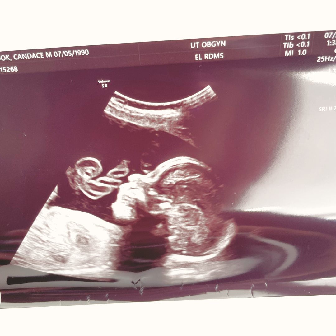 Photo shared by Candace for their Babylist baby registry.