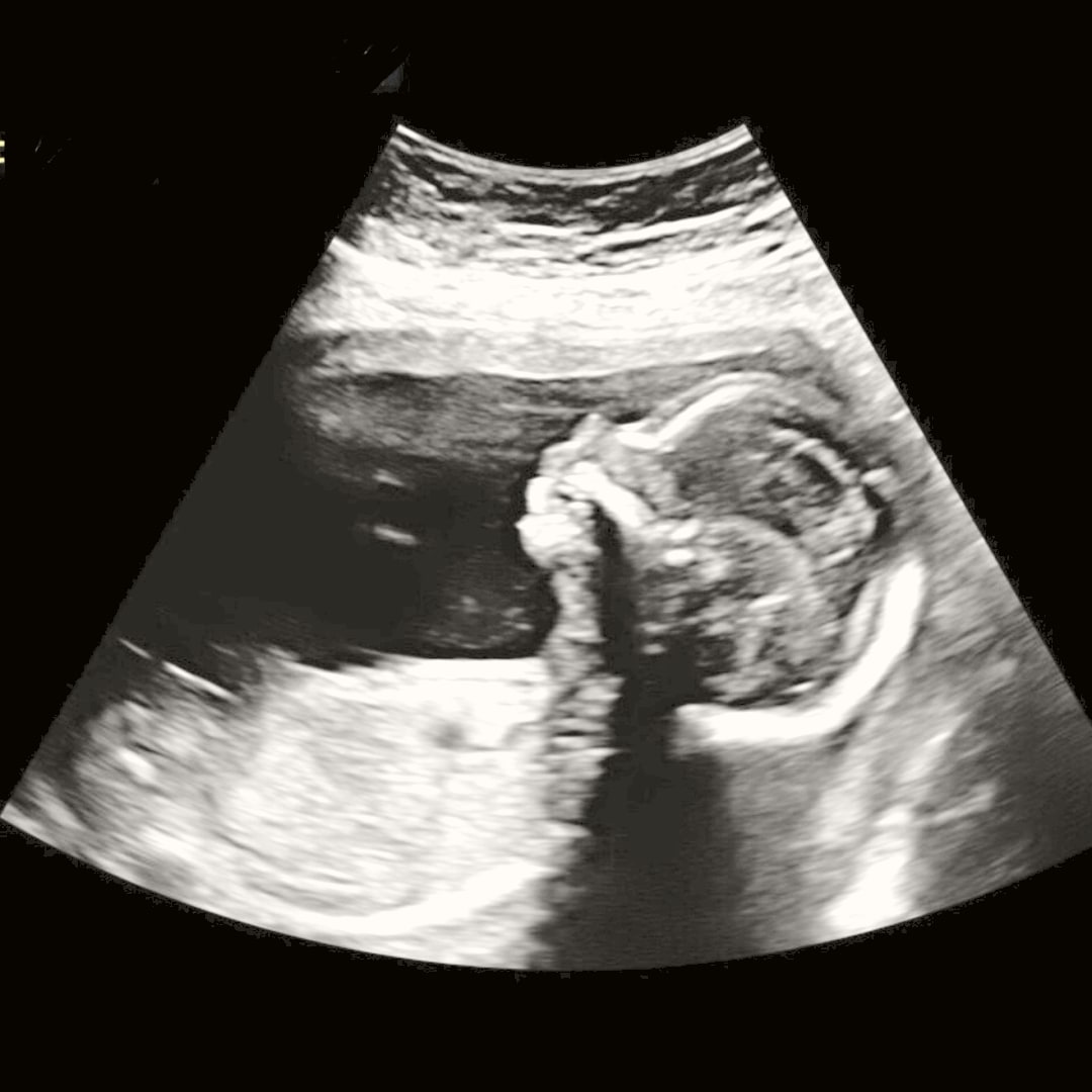Photo shared by Jessica for their Babylist baby registry.