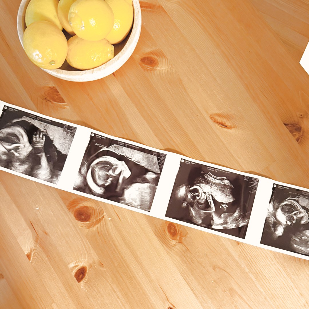 Photo shared by Marie for their Babylist baby registry.