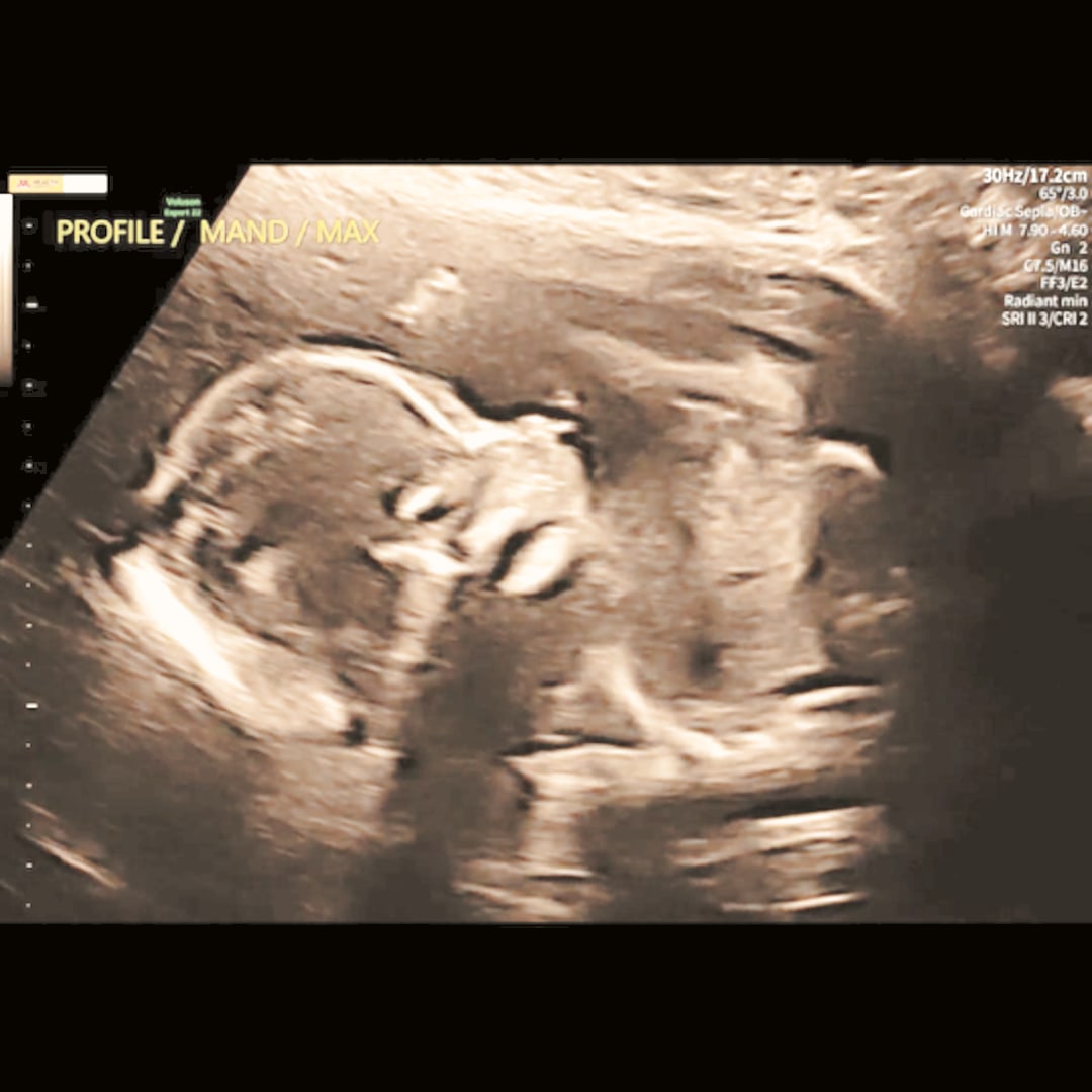 Photo shared by Tory for their Babylist baby registry.