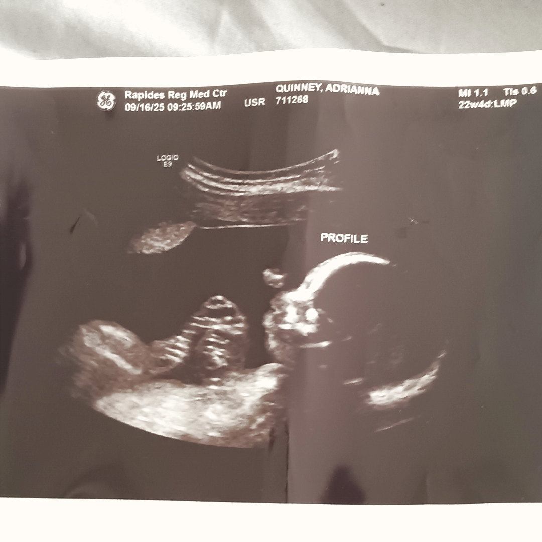 Photo shared by Adrianna for their Babylist baby registry.