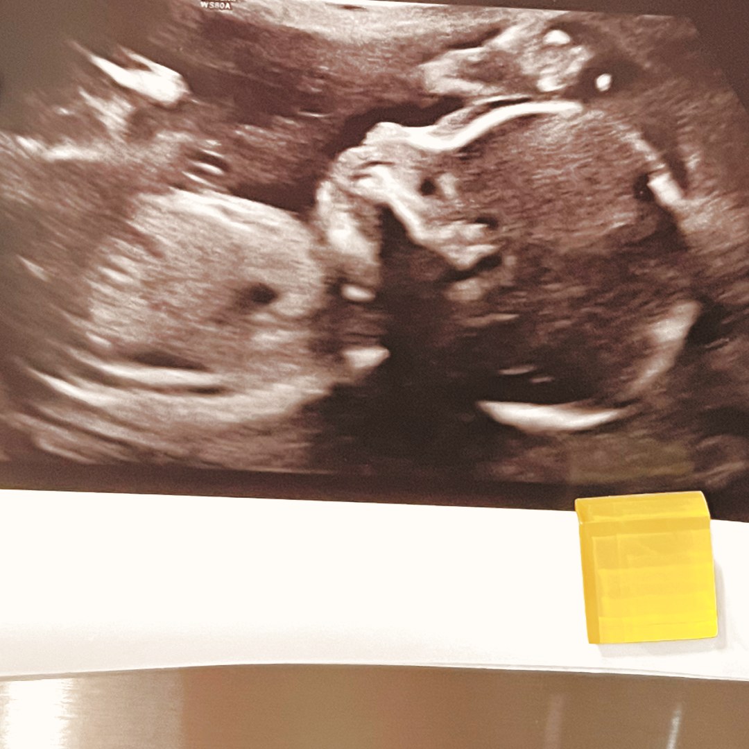 Photo shared by Stacy for their Babylist baby registry.