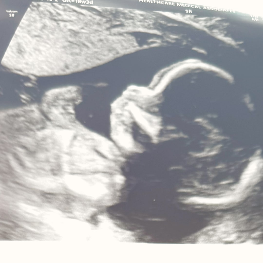 Photo shared by Sofia for their Babylist baby registry.