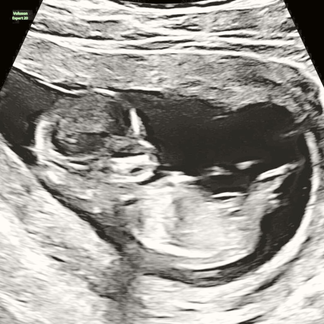Photo shared by Jayme for their Babylist baby registry.