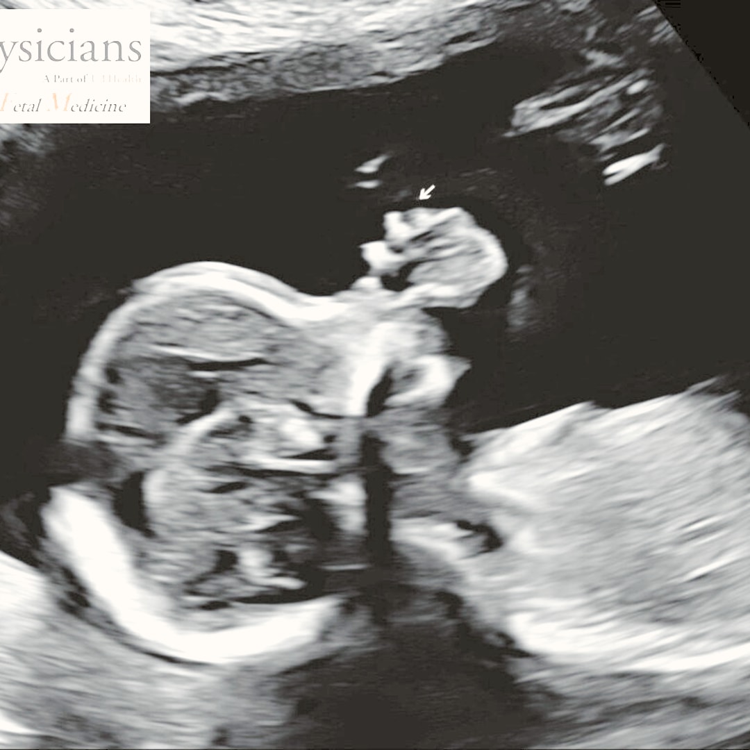 Photo shared by Christian for their Babylist baby registry.