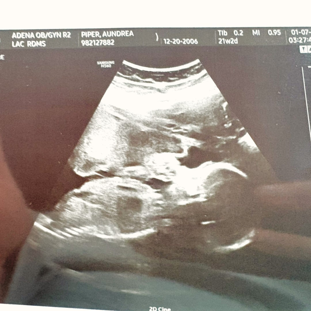 Photo shared by Aundrea for their Babylist baby registry.