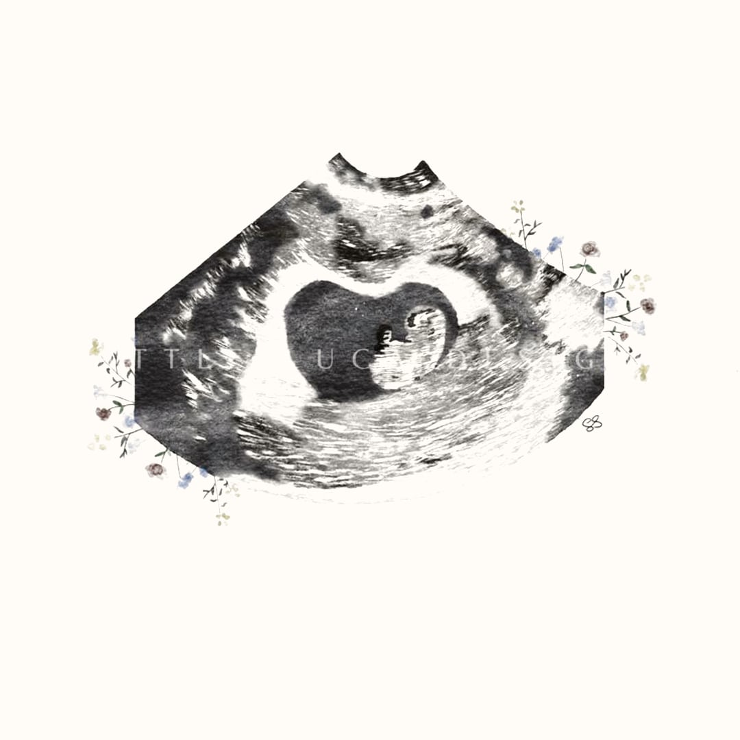 Photo shared by Allyssa for their Babylist baby registry.