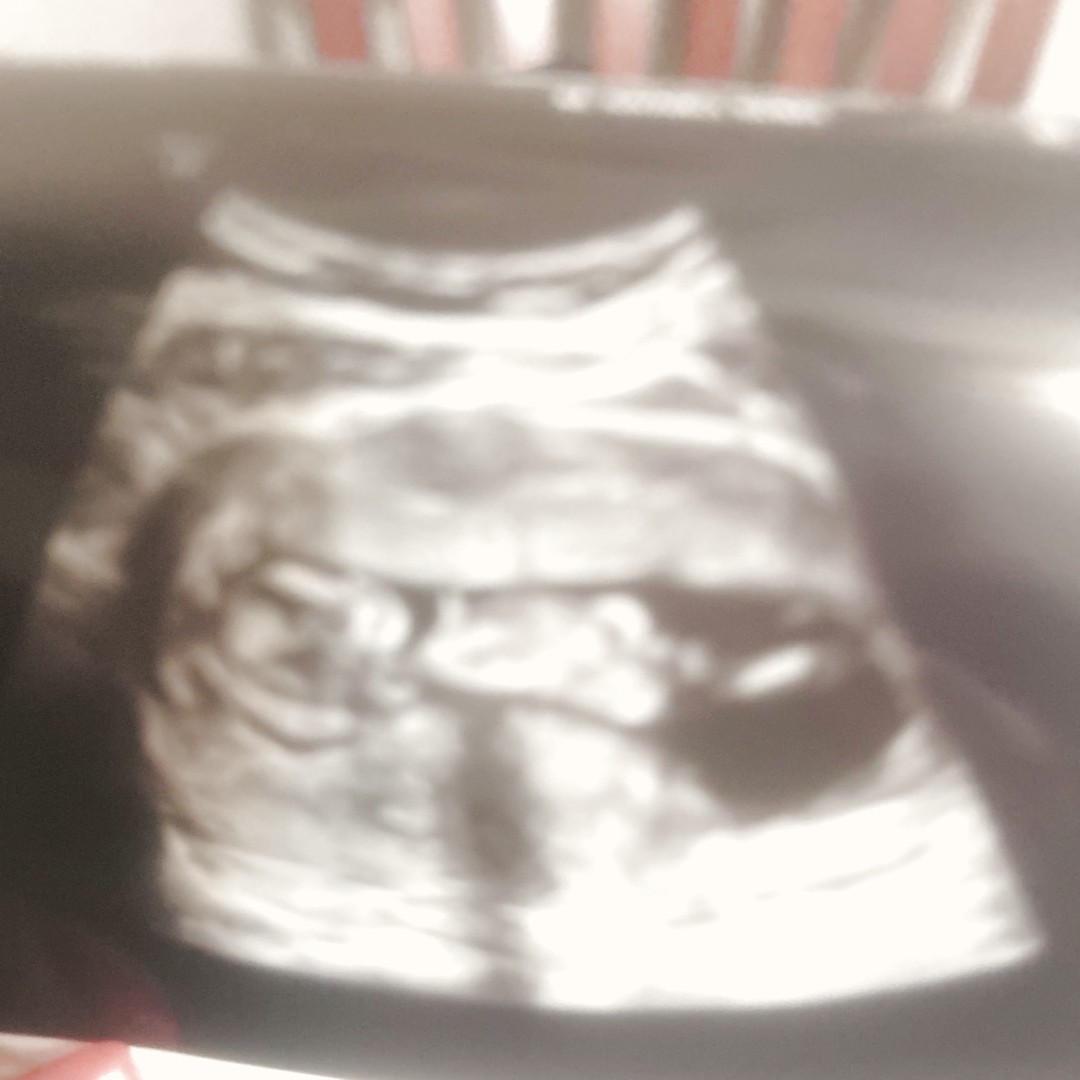 Photo shared by Kenya for their Babylist baby registry.