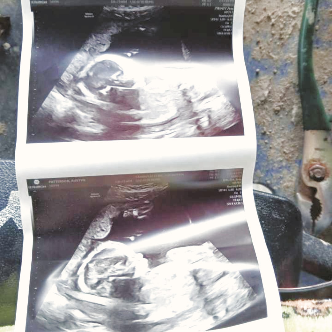 Photo shared by Austyn for their Babylist baby registry.