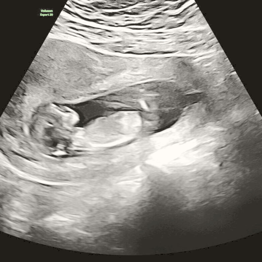 Photo shared by Isa for their Babylist baby registry.