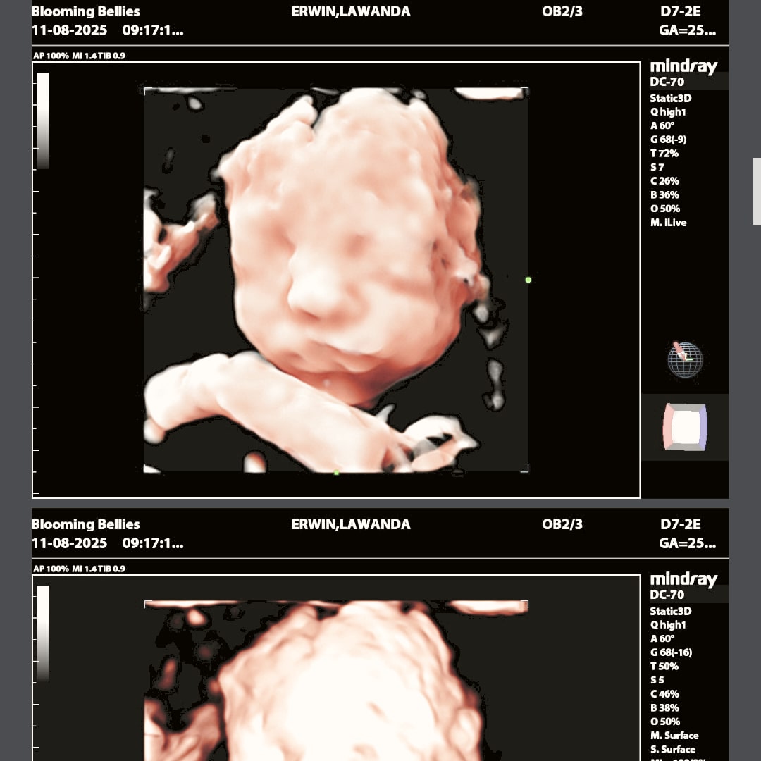 Photo shared by LaWanda for their Babylist baby registry.