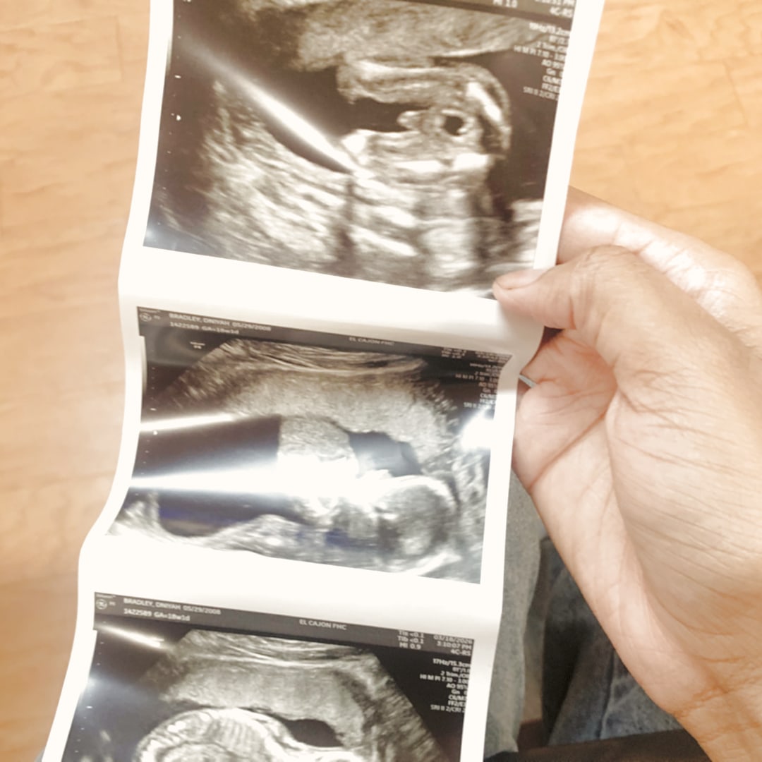 Photo shared by Dniyah for their Babylist baby registry.