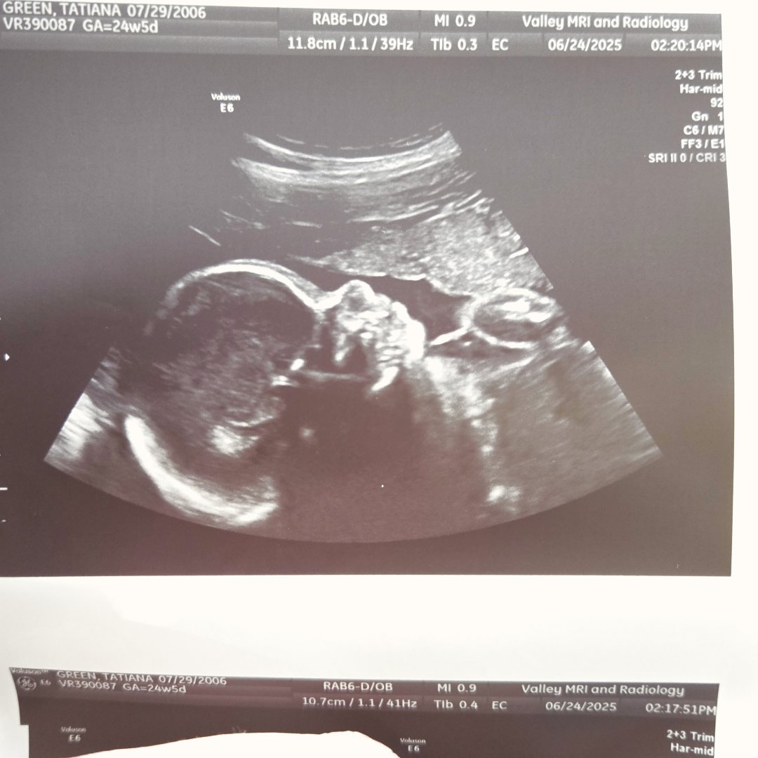 Photo shared by Tatiana for their Babylist baby registry.