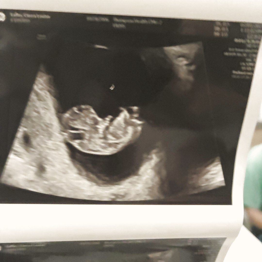 Photo shared by Cierra for their Babylist baby registry.