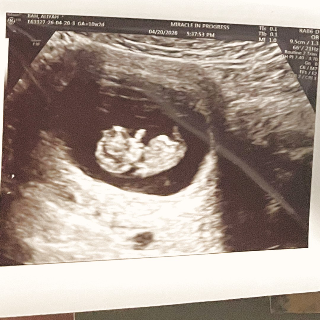 Photo shared by Aliyah for their Babylist baby registry.