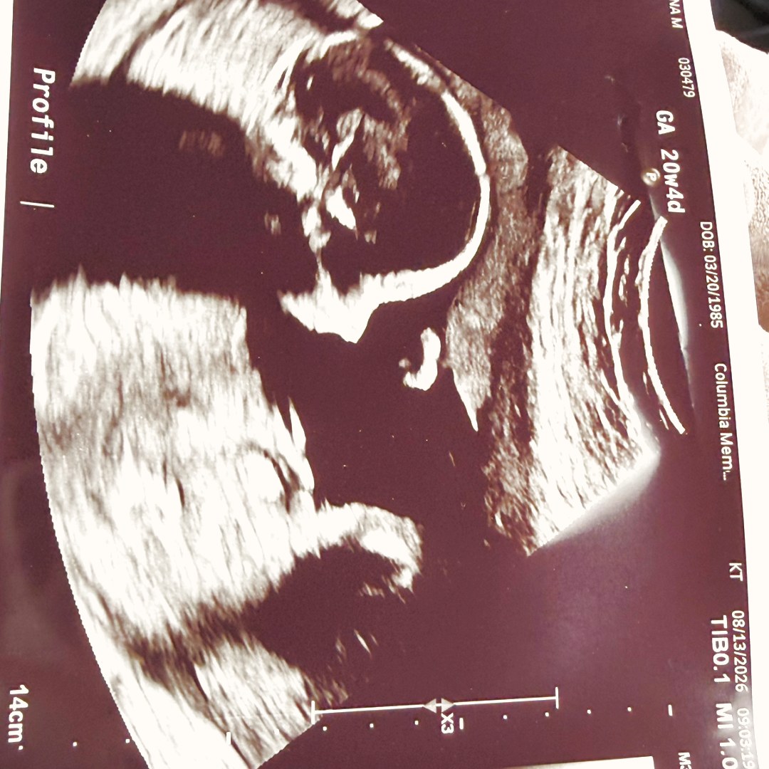 Photo shared by Gena for their Babylist baby registry.