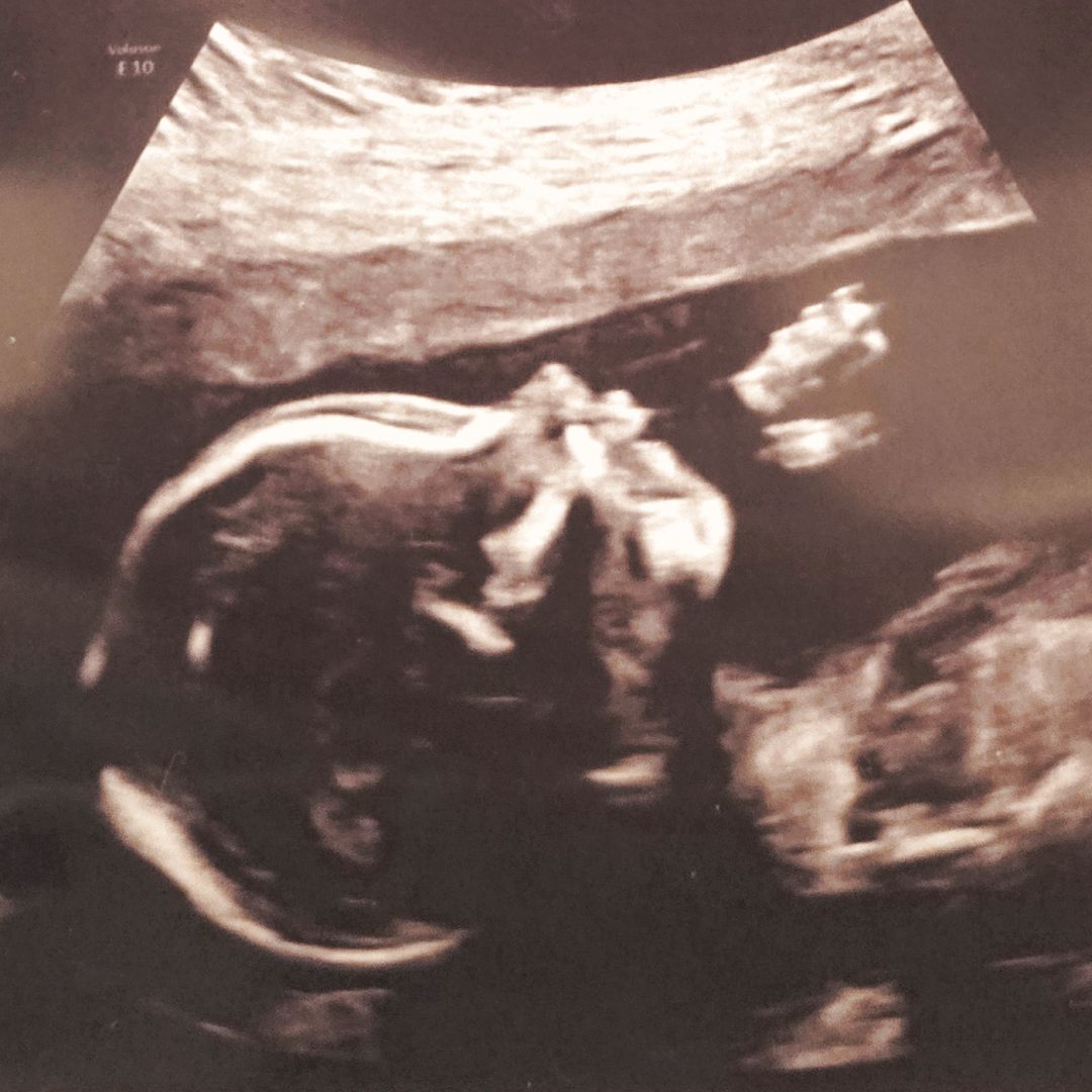 Photo shared by Kai'lee for their Babylist baby registry.