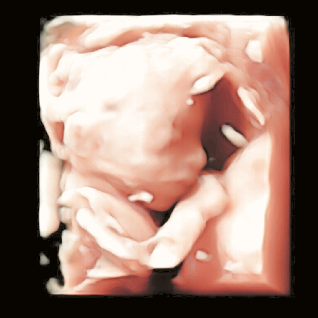 Photo shared by Arielle for their Babylist baby registry.