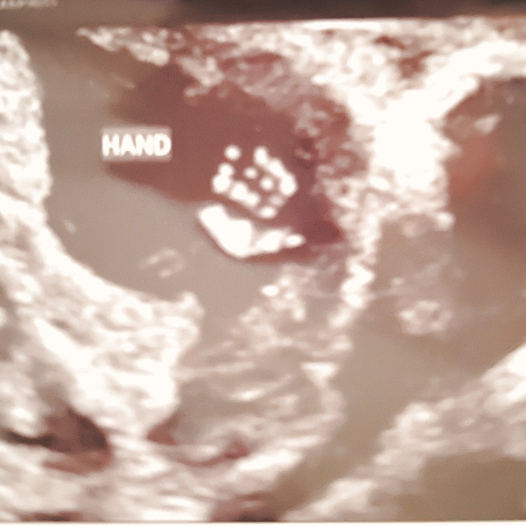 Photo shared by Latosha for their Babylist baby registry.
