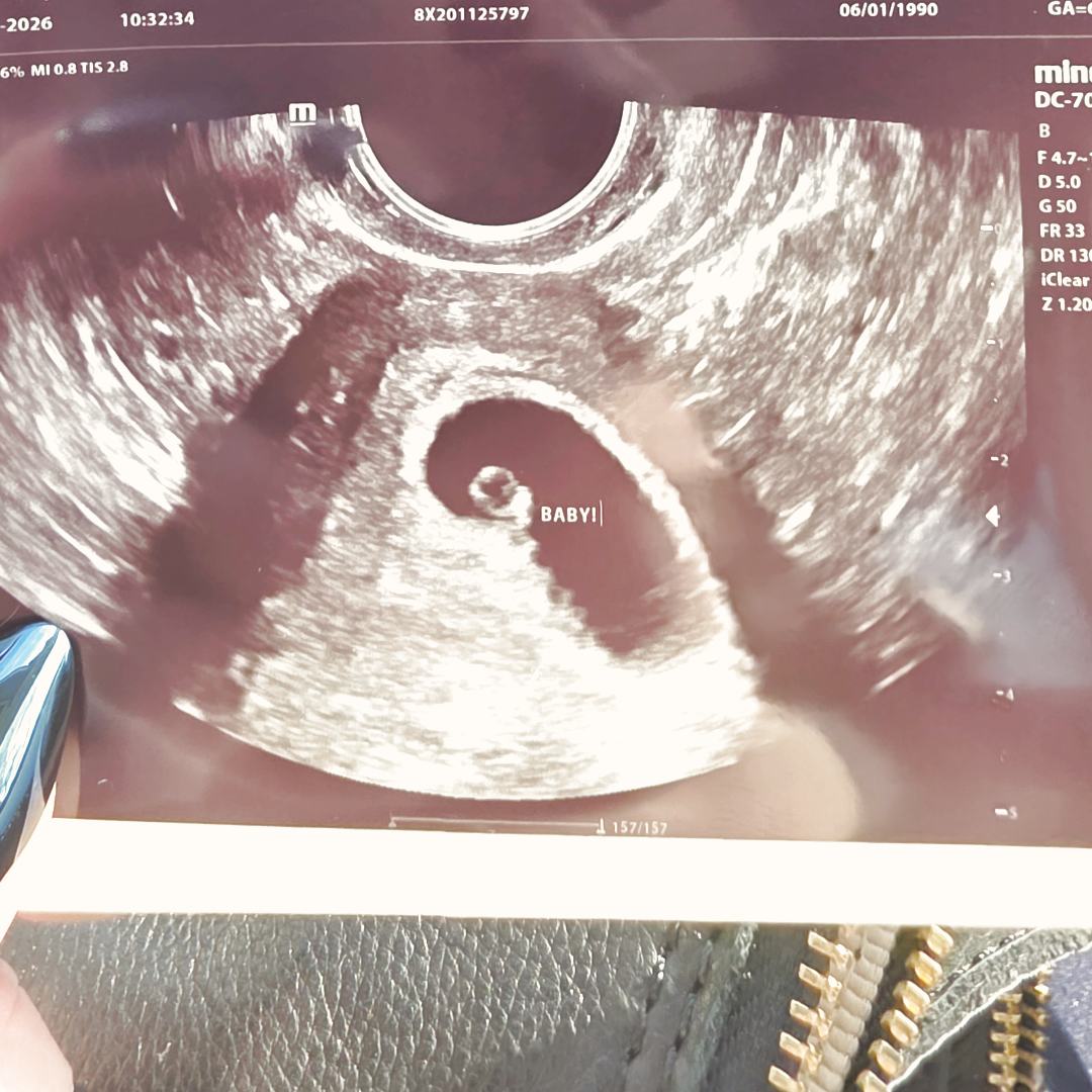 Photo shared by Andrea for their Babylist baby registry.