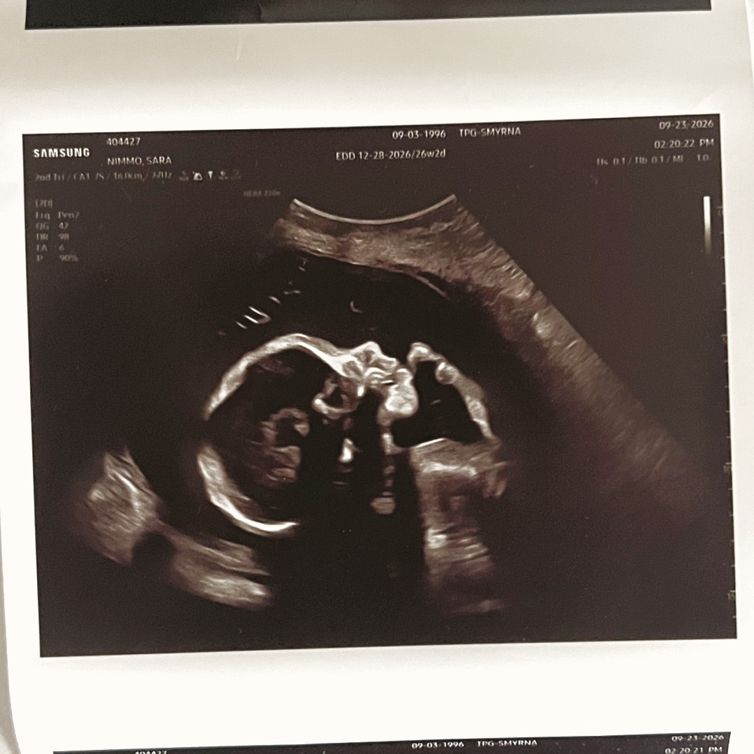 Photo shared by Sara for their Babylist baby registry.