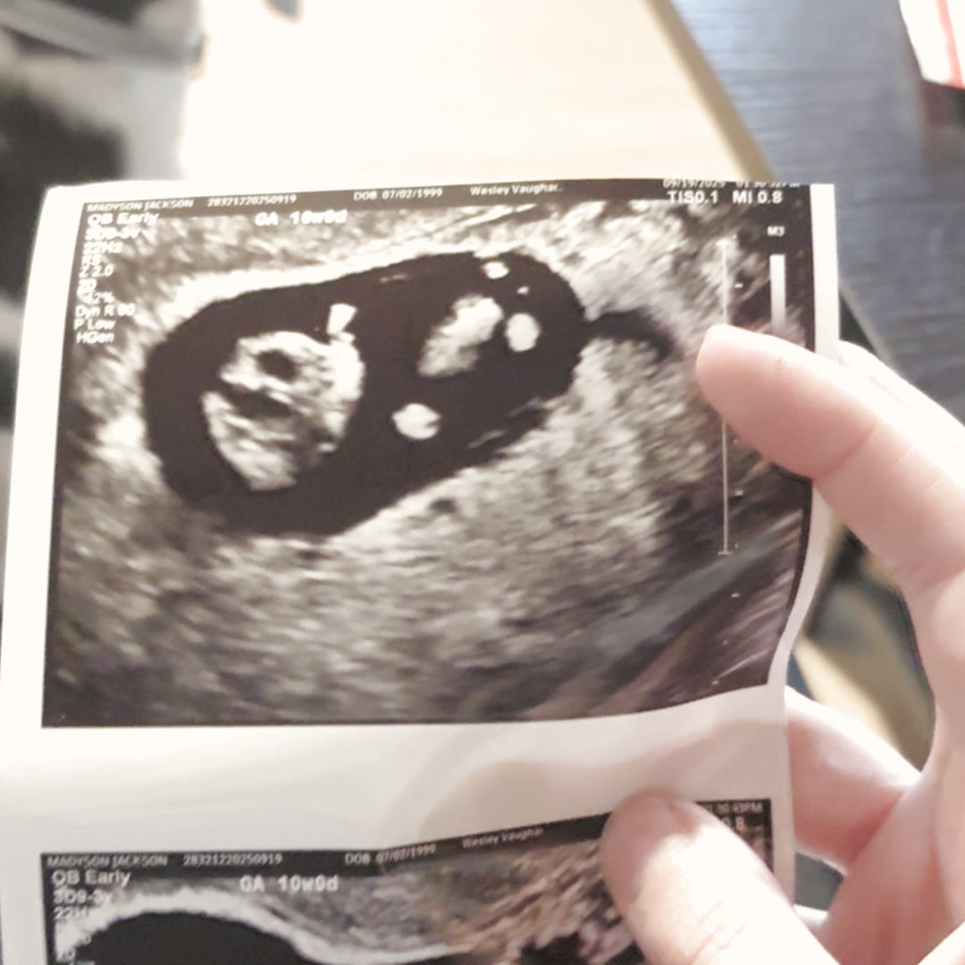 Photo shared by Madyson for their Babylist baby registry.