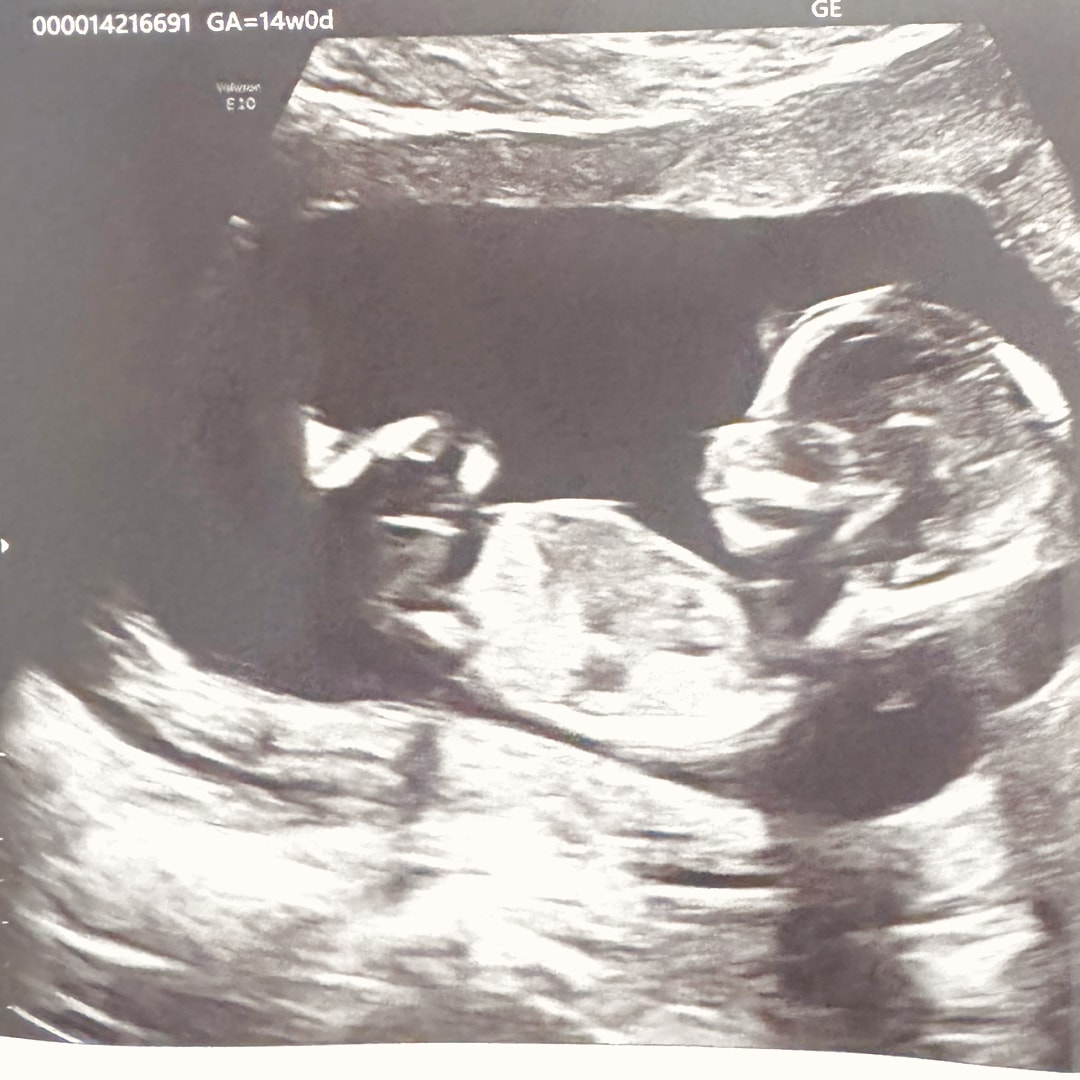 Photo shared by Samantha for their Babylist baby registry.