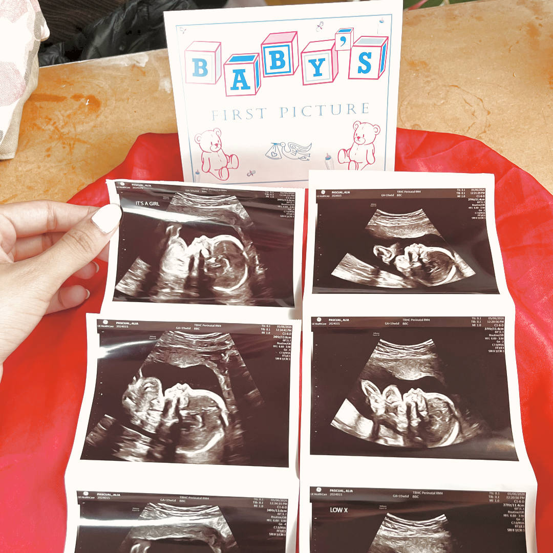 Photo shared by Alia Rosa for their Babylist baby registry.