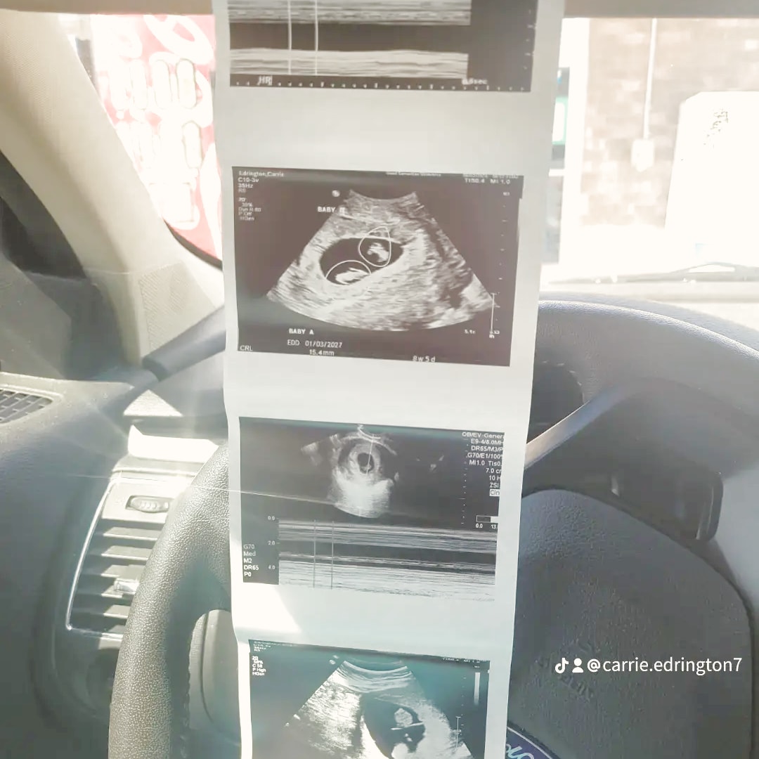 Photo shared by Carrie for their Babylist baby registry.