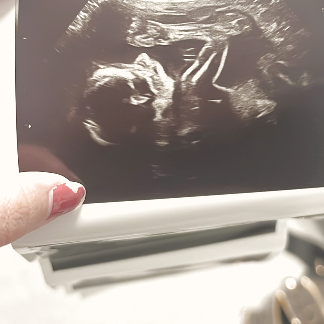 Photo shared by Florian for their Babylist baby registry.