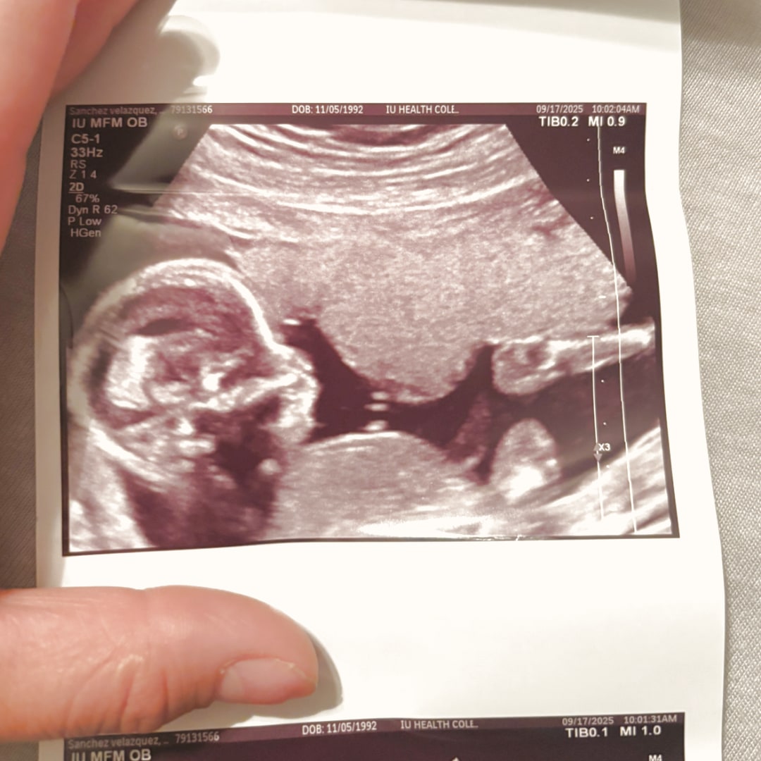 Photo shared by Elizabeth for their Babylist baby registry.