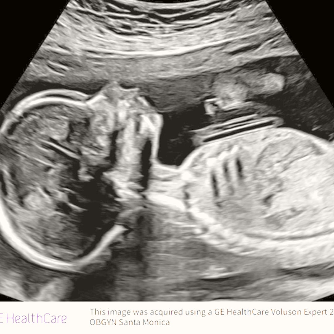 Photo shared by Mario for their Babylist baby registry.