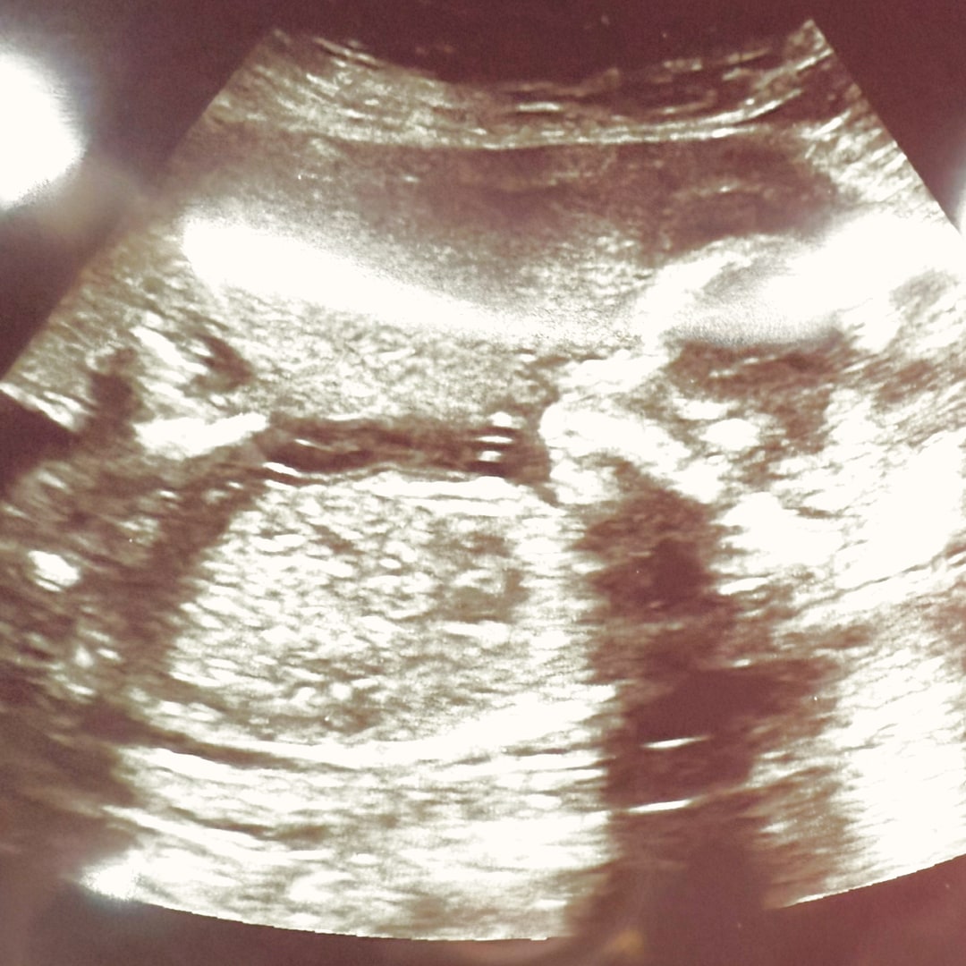 Photo shared by Kassandra for their Babylist baby registry.