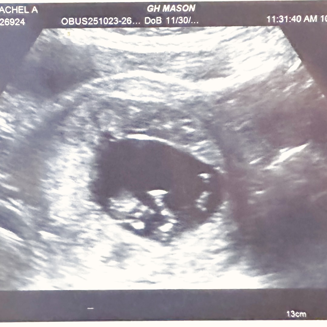 Photo shared by Rachel for their Babylist baby registry.