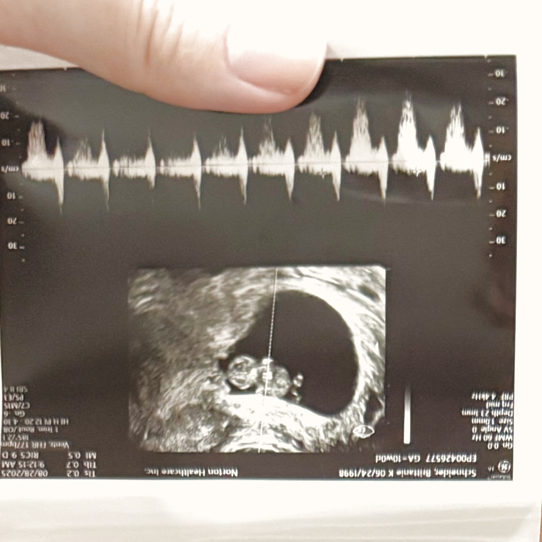 Photo shared by Brittanie for their Babylist baby registry.