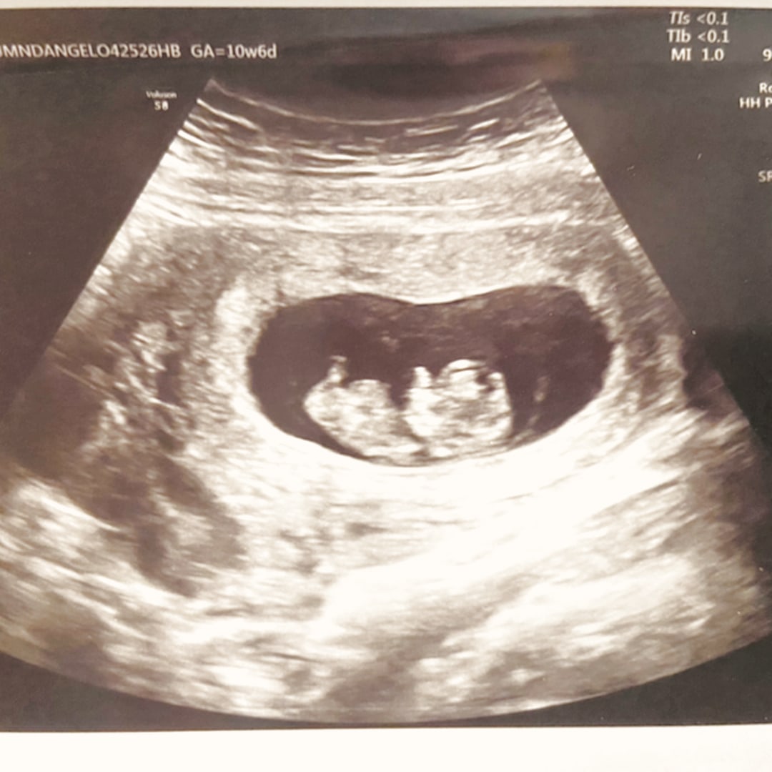 Photo shared by Autumn for their Babylist baby registry.