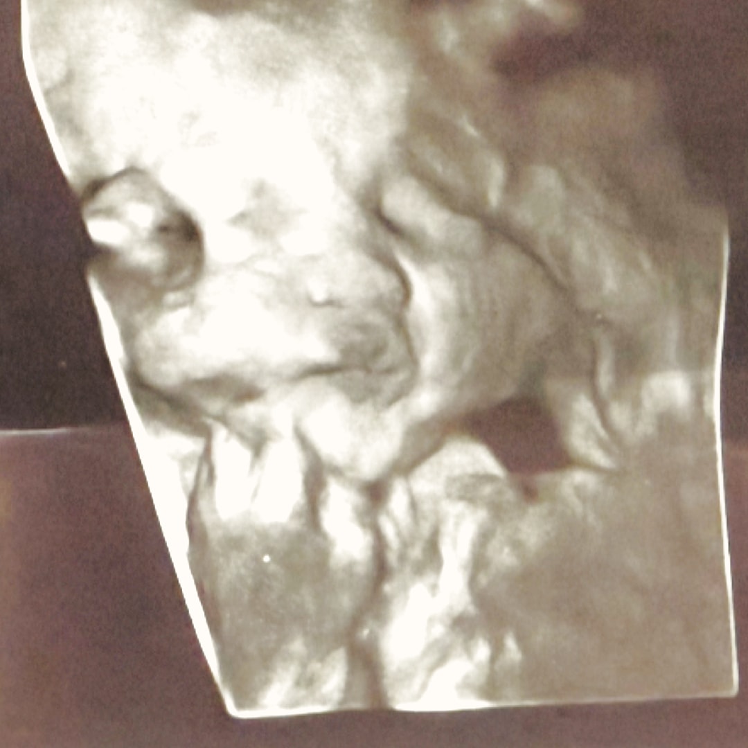 Photo shared by Karyssa for their Babylist baby registry.